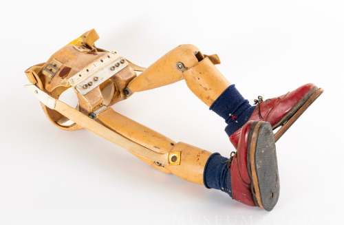 Child Prosthetic Legs
